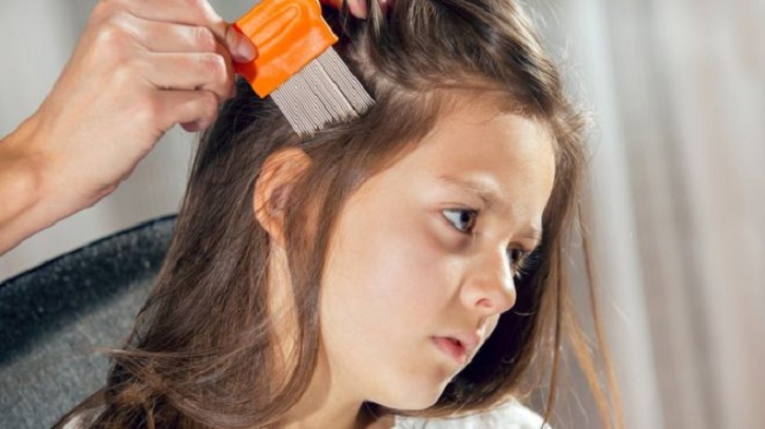 Itchy business: The growth of head lice removal firms